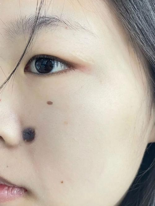 澳门科技大学读研和孙俪唇下痣没了与孙俪嘴唇的痣