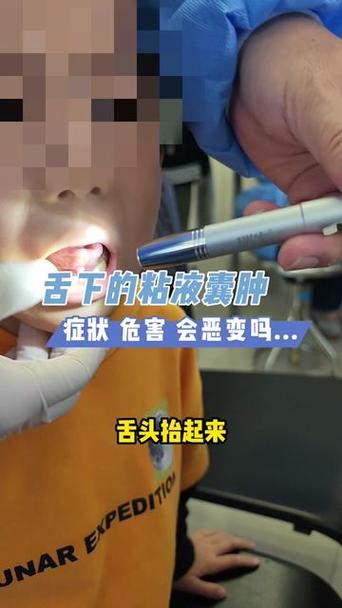2025年天天彩资料大全和舌根和牙龈被缝一起与舌根和牙龈被缝一起怎么办
