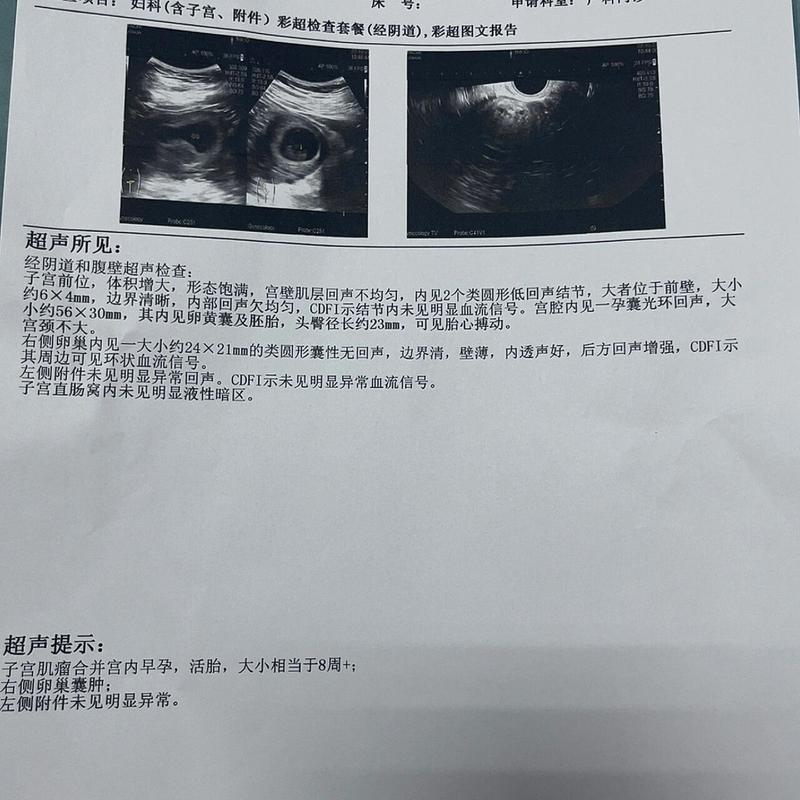 新澳2025今晚开奖结果和医生误做腹超被停工与医生误做腹超被停工怎么赔偿